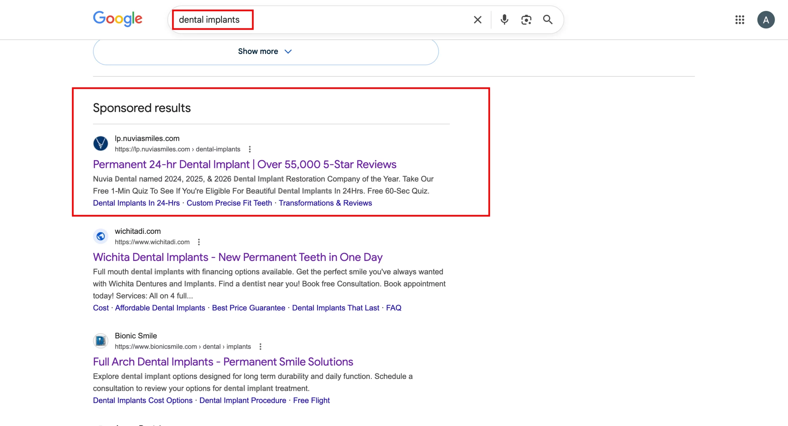 Google SERP for dental implants showing Nuvia Smiles as top sponsored result with headline Permanent 24-hr Dental Implant Over 55000 5-Star Reviews